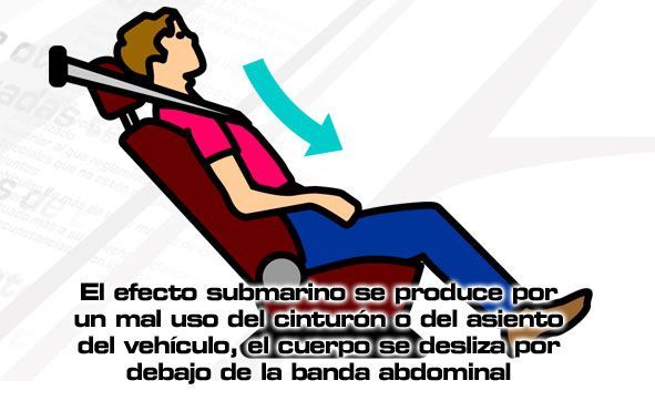 Elementos pasivos