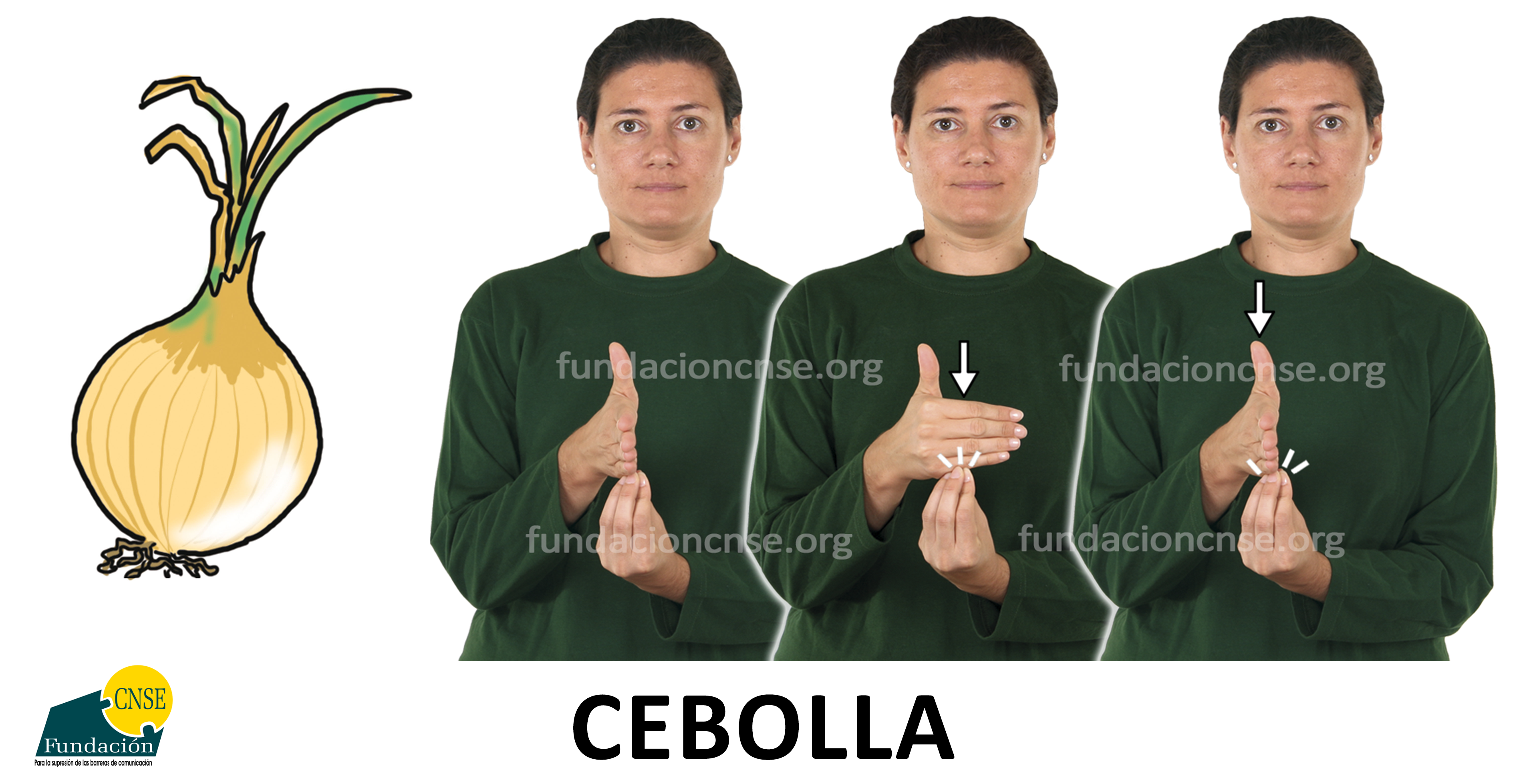 cebolla